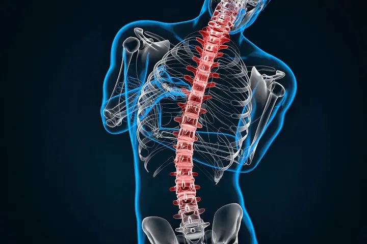 spondylosis-scoliosis-3d-illustration-contains-clipping-path